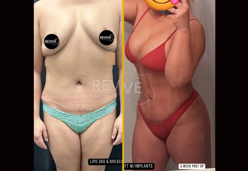 03-2