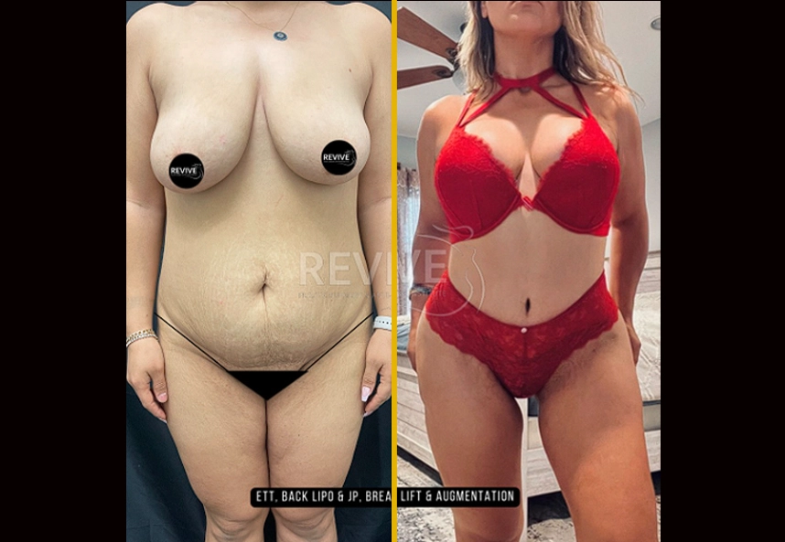 28
