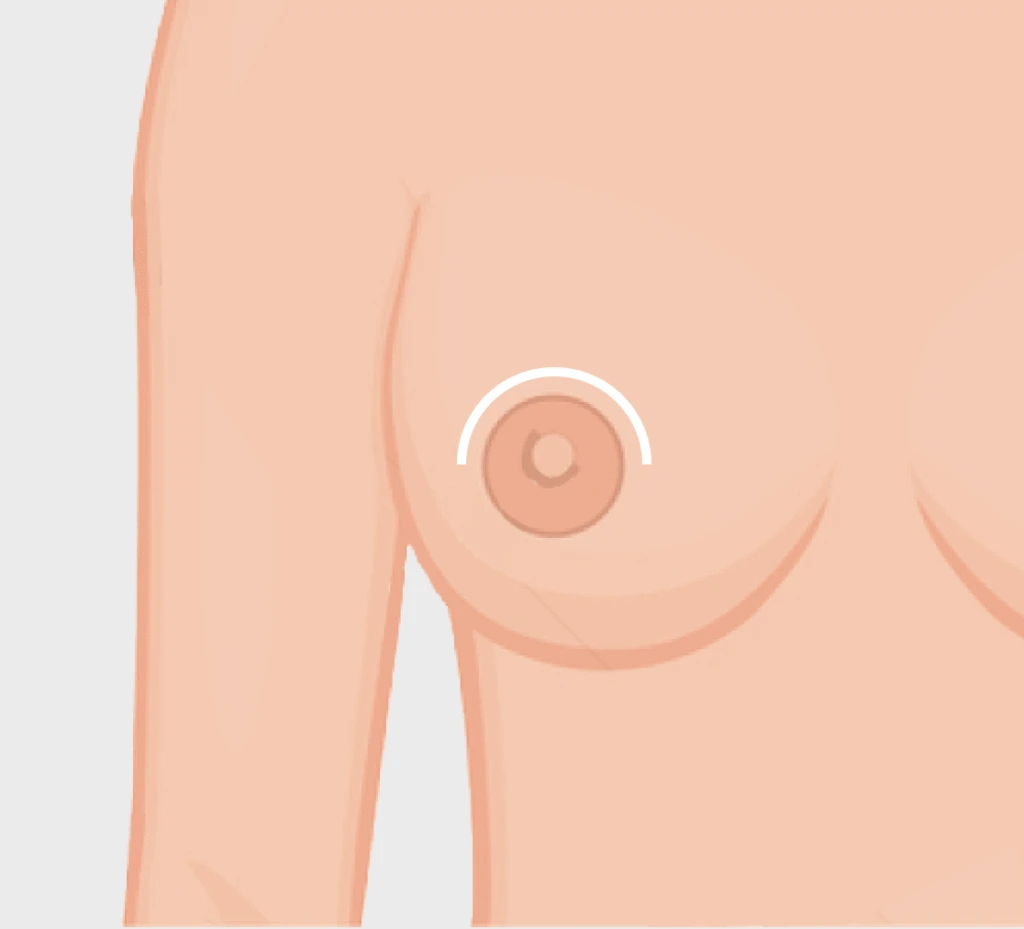 Breast Lift with Implants Miami, FL: Breast Lift with Implant Techniques Banner