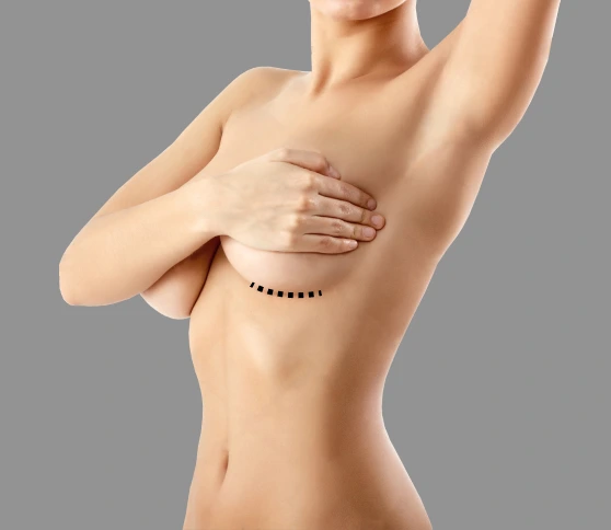 Breast Augmentation Miami, FL: Types of Incisions for a Breast Augmentation Banner