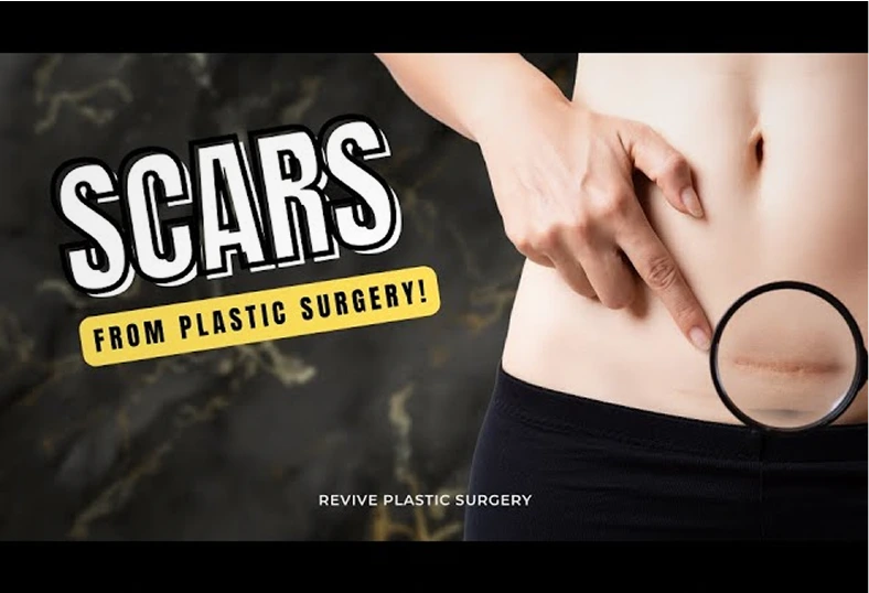 Scar Care Lower Body Lift Miami FL Banner