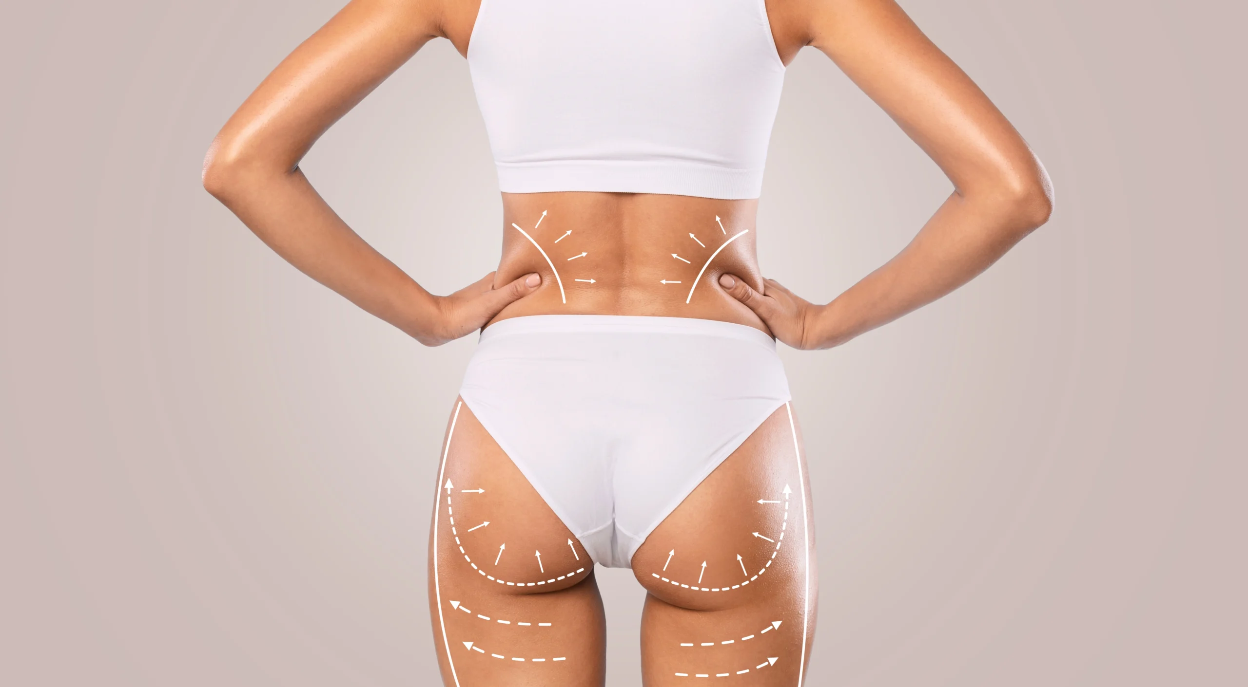 Lipo Without Tummy Tuck: What Kind of Results Can You Expect? Banner