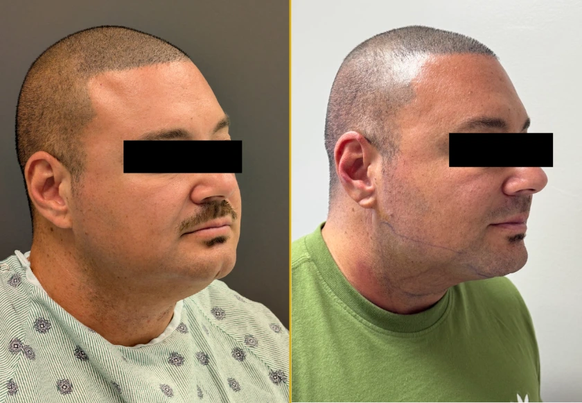 Revive Gallery Template (602 x 230 px) (1)