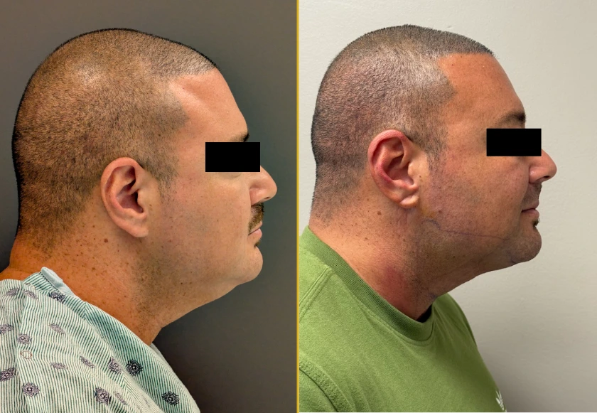 Revive Gallery Template (602 x 230 px) (2)