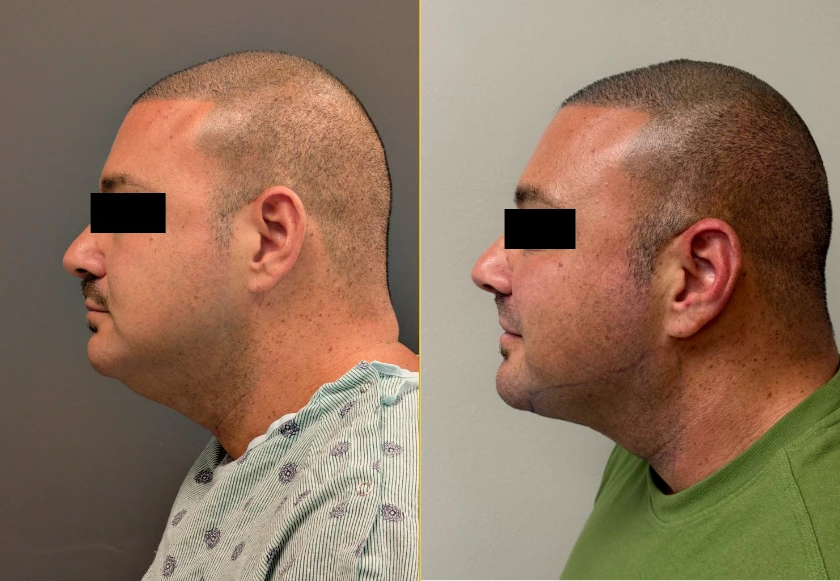 Revive Gallery Template (602 x 230 px) (4)