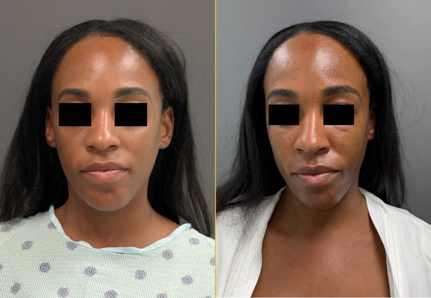 Revive Gallery Template (602 x 230 px) (5)