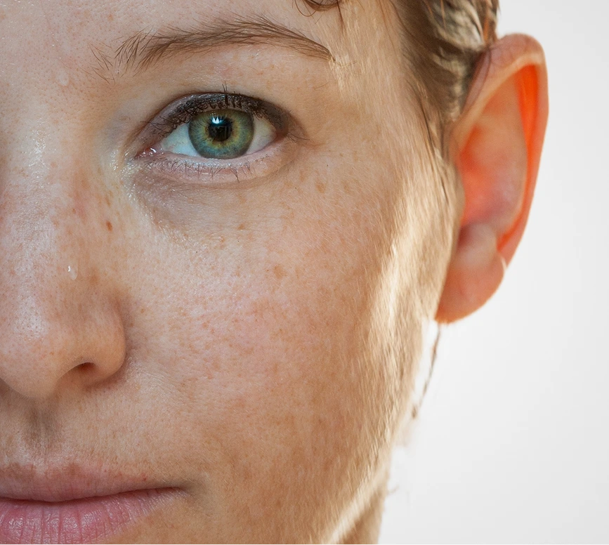 Halo Laser Skin Treatment Miami, FL Banner